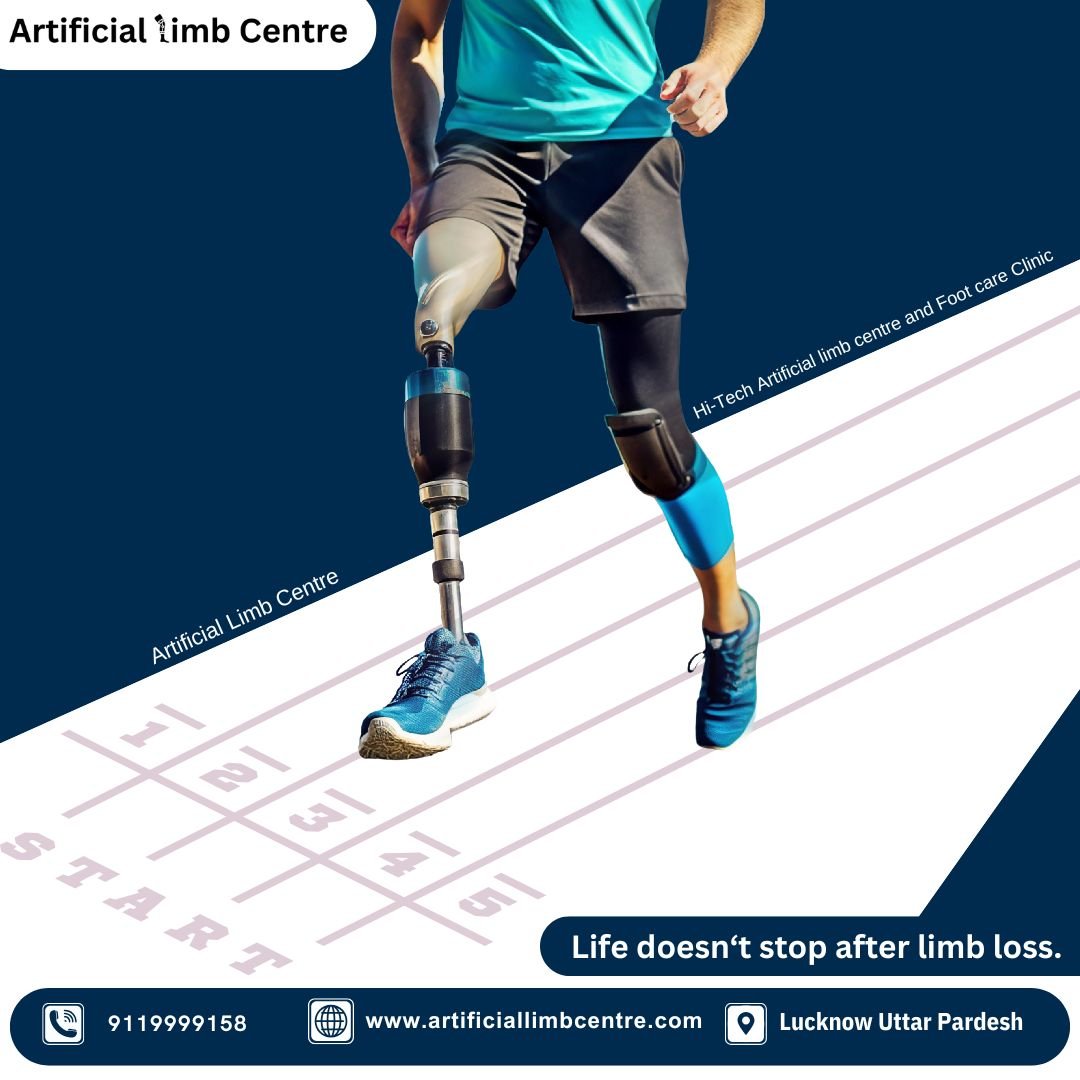 if you are searching best Artificial limb centre in Lucknow then visit Artificiallimbcentre in Lucknow Uttar Pradesh.