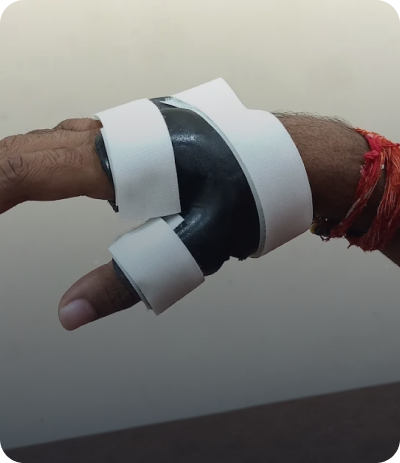 Hand Orthotics